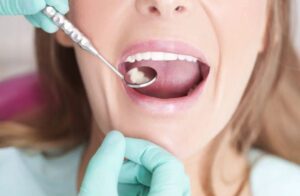 Dental Checkup in Bryn Mawr