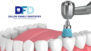 Teeth cleaning main line