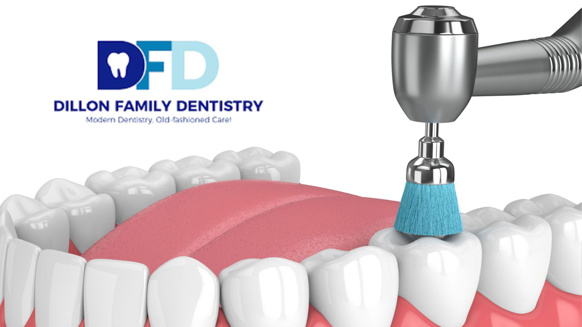 Read more about the article Teeth Cleaning in the Main Line: Why Regular Cleanings Matter