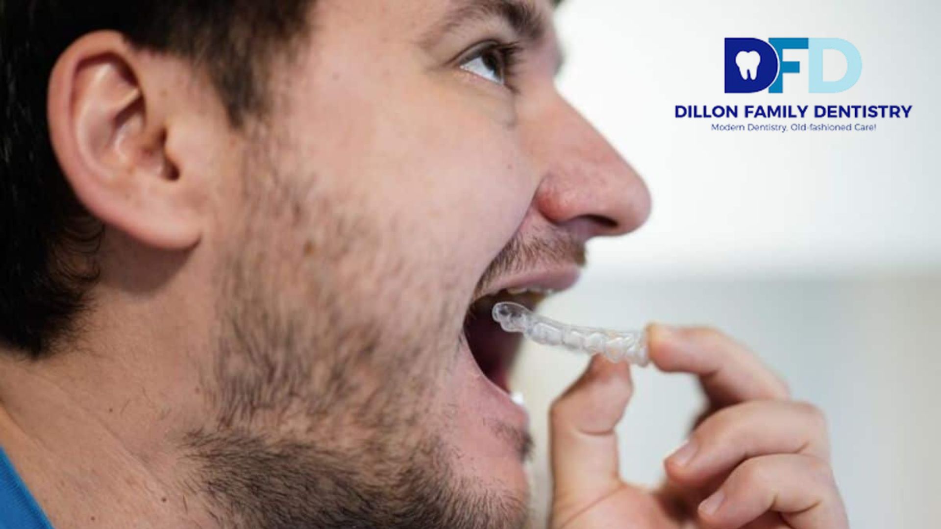 Read more about the article Why Wearing Your Invisalign Retainer at Night Is Essential for Long-Term Results