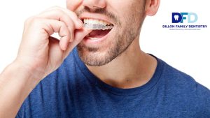 Teeth Shifting