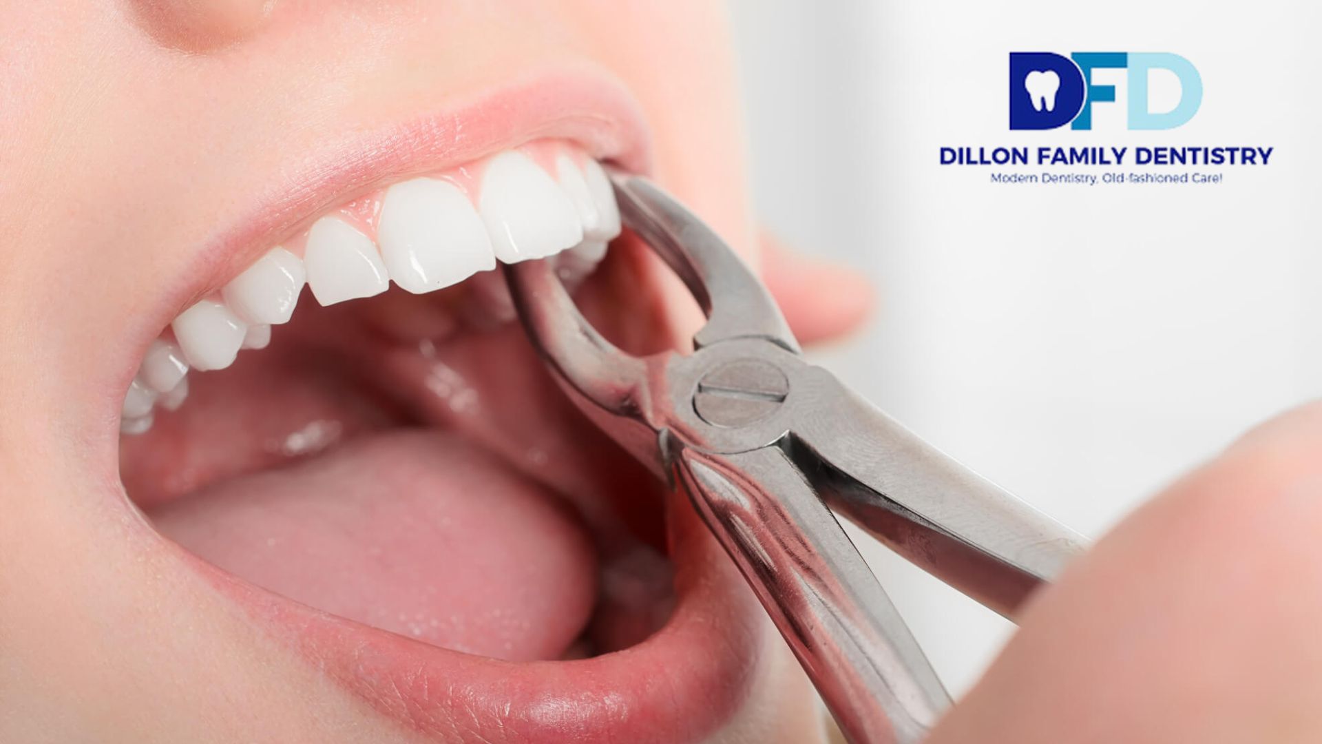 Read more about the article How Painful Is a Tooth Extraction? 