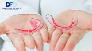 Invisalign